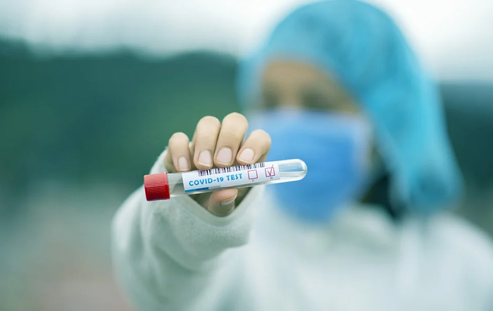 Coronavirus: 5.5% der in Piemont getesteten Personen sind positiv, 10.5%  in Novara